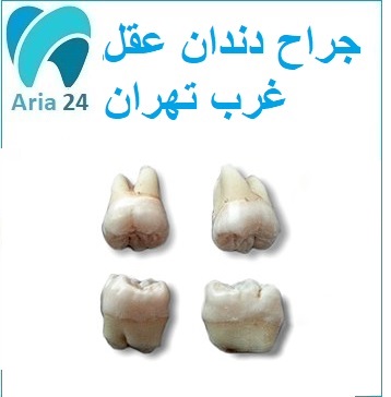 بهترین جراح دندان عقل در غرب تهران